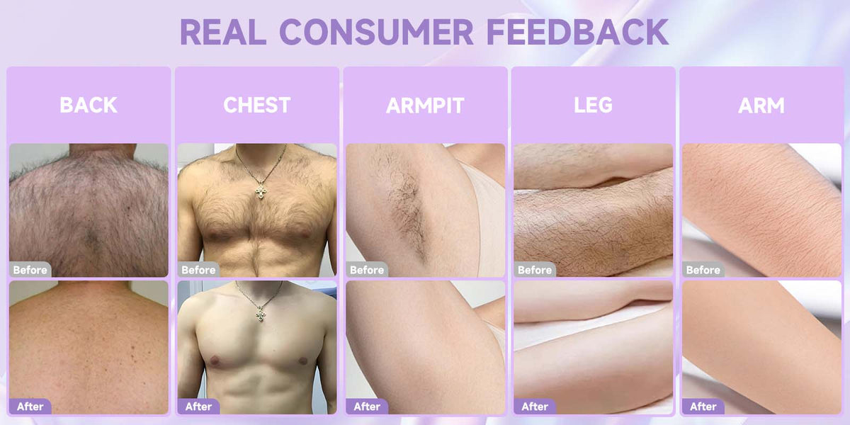 Customer before and after on back, chest, armpit, leg and arm
